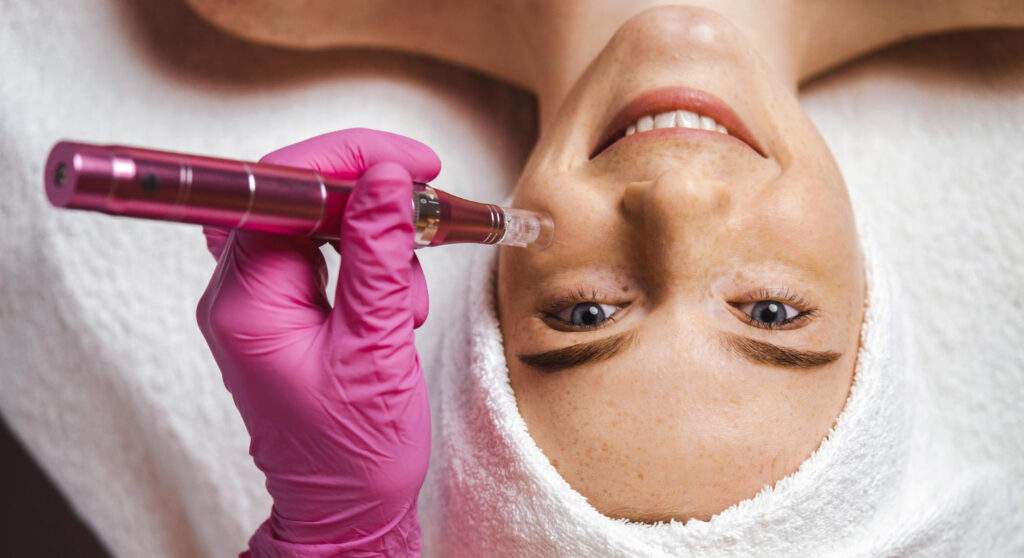 Artículo de Microneedling: cómo mejora la calidad de la piel y por qué Dermapen se ha vuelto tan popular