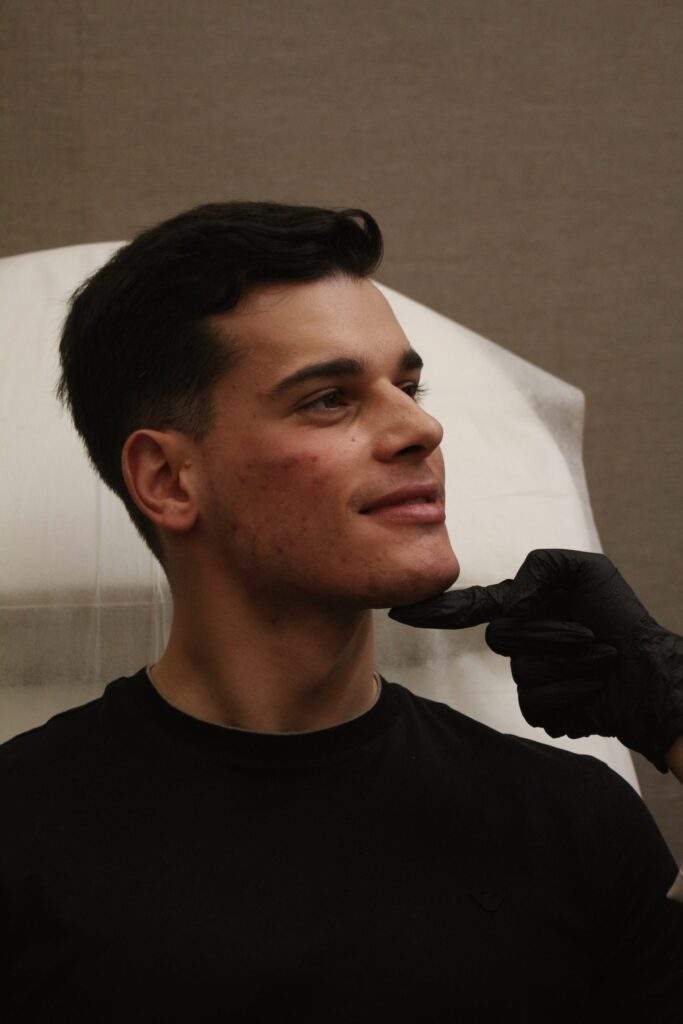 Tratamiento de medicina estética facial de marcación mandibular en príncipe de Vergara