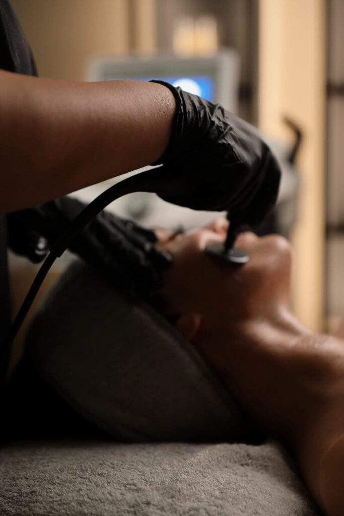 Estética avanzada facial con tratamiento Indiba en Príncipe de Vergara